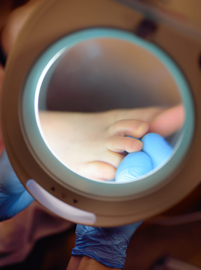 A dermatologist examines a little child foot using a dermatoscopy. Podiatrist dermatologist doctor treatment of foot skin and nail of baby patient.